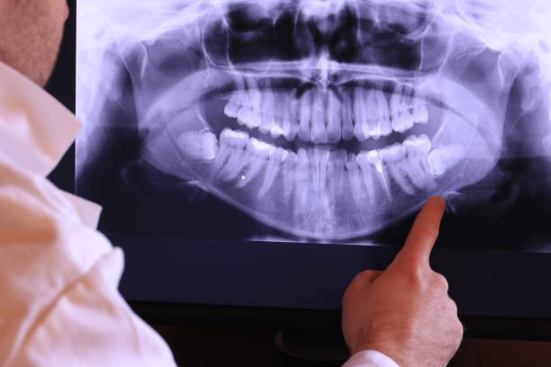 Best Cracked Tooth Emergency Dentist  in Eureka, KS