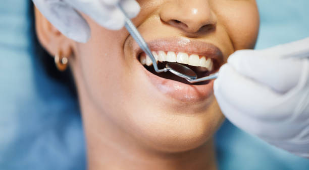 Best Dentist for Tooth Abscess  in Eureka, KS